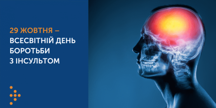 29 жовтня – Всесвітній день боротьби з інсультом: як розпізнати симптоми та чому важливо зробити це вчасно