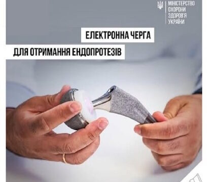 Електронна черга для отримання ендопротезів